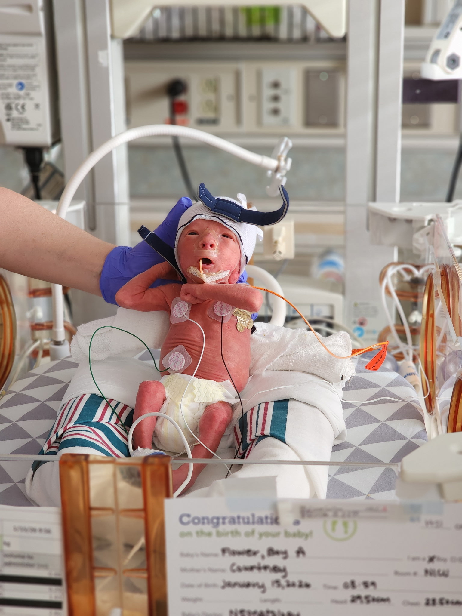 Small premature baby held up in NICU with cords and wires strapped to his body